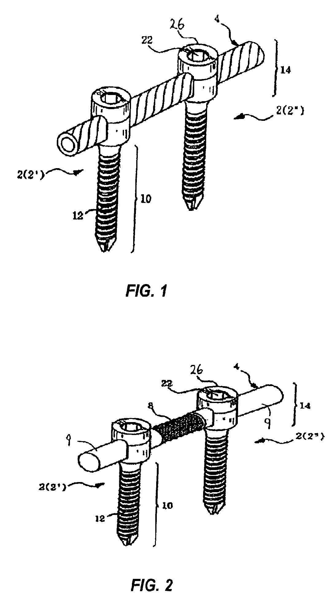 Spinal stabilization device