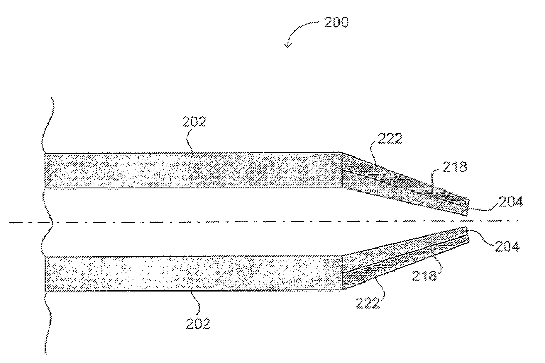 Ocular implant with intraocular fluid pressure regulation