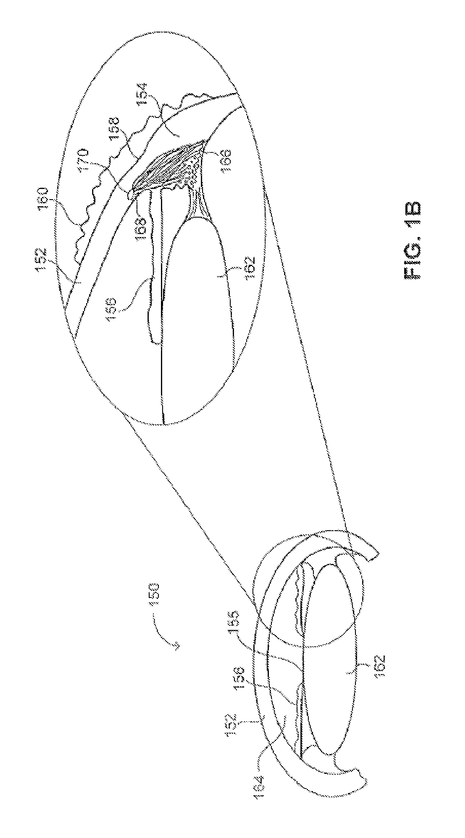 Ocular implant with intraocular fluid pressure regulation