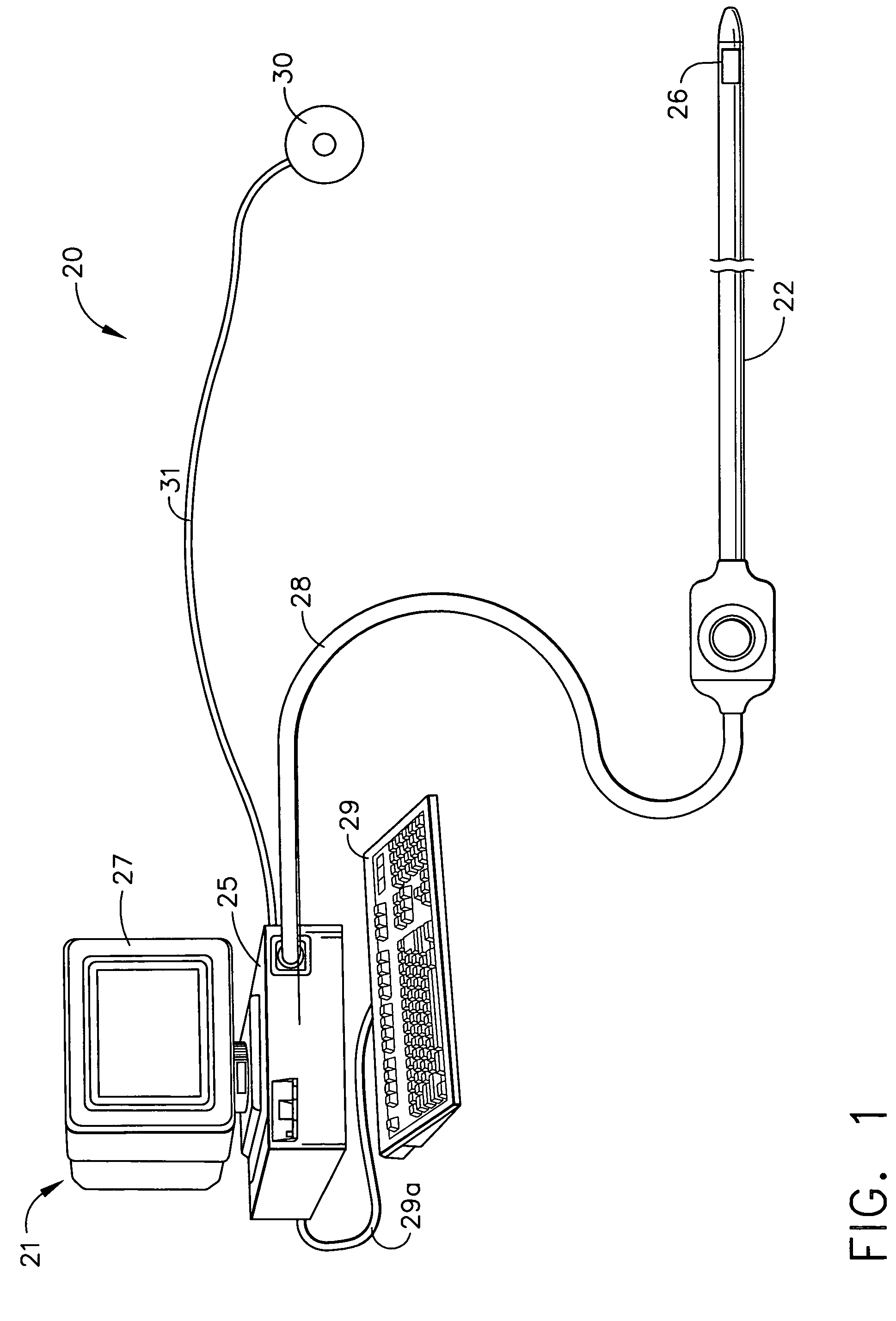 Medical system calibration with static metal compensation