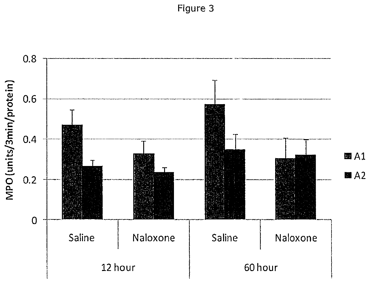 Beta-casein a2 and reducing or preventing symptoms of lactose intolerance