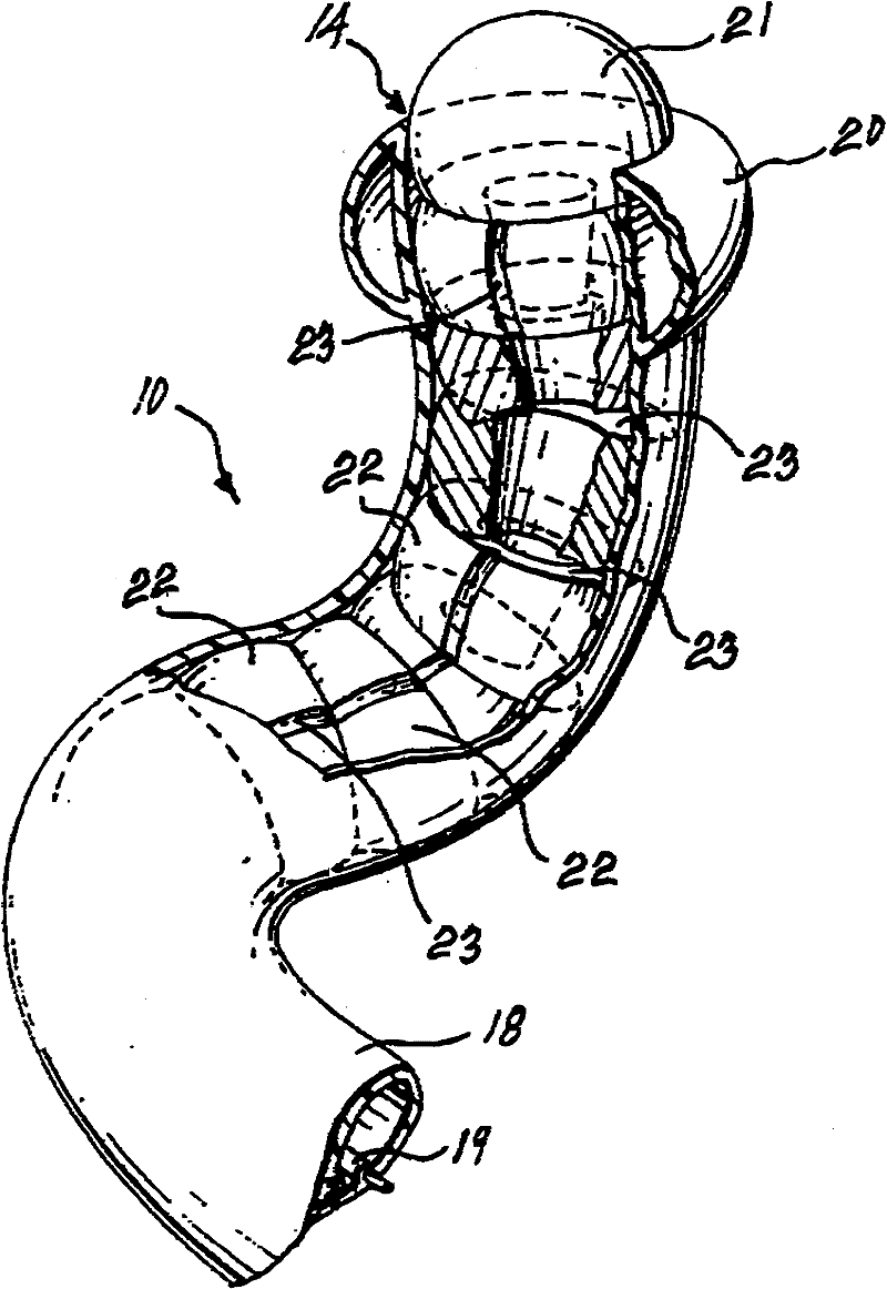 Internal viewing device with high degree of freedom of movement and method of operation thereof