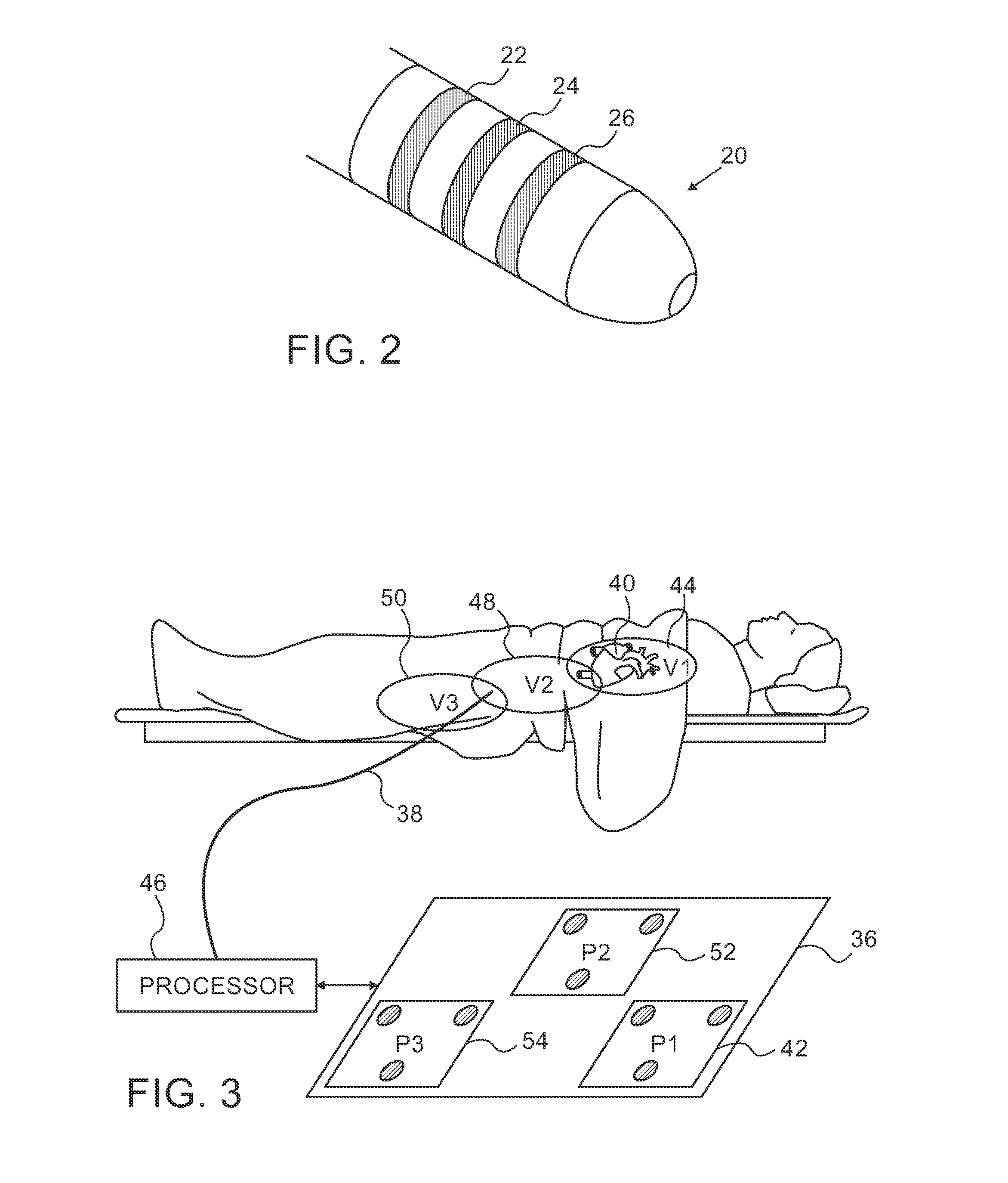 Tracking of catheter from insertion point to heart using impedance measurements