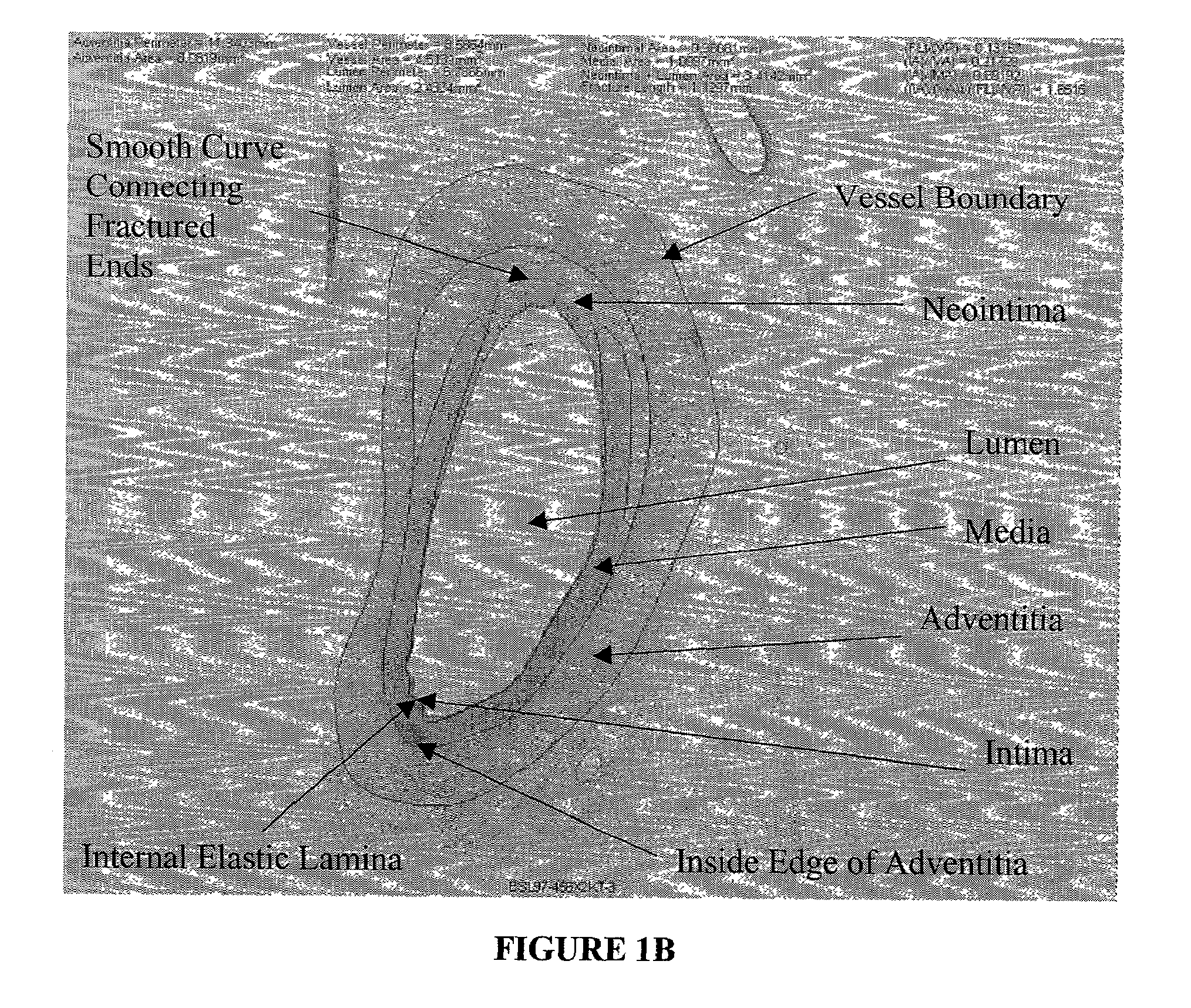 Method for quantitative analysis of blood vessel structure