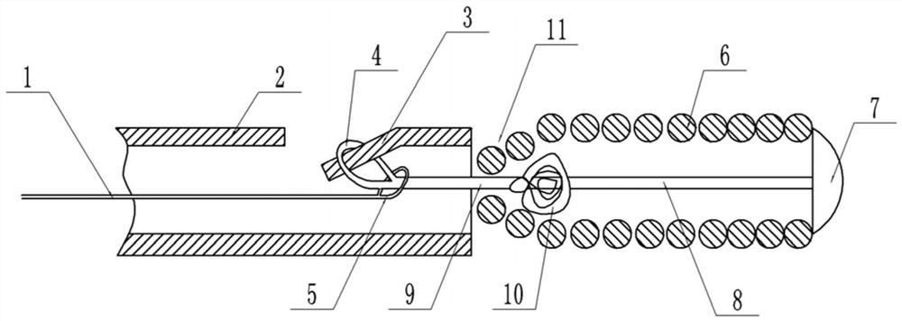 Mechanical release coil system