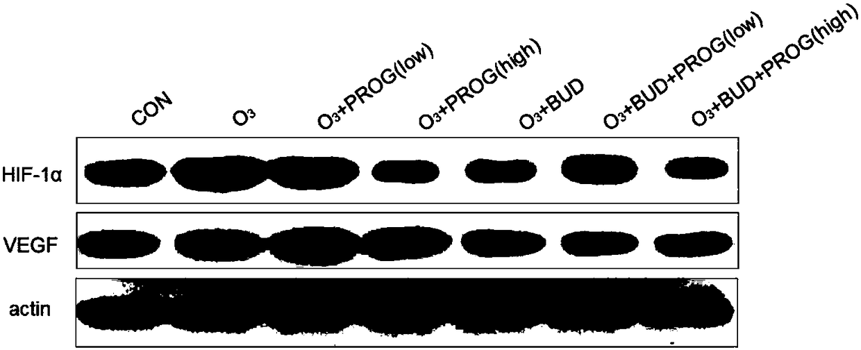 Application of progesterone to preparation of medicines for inhibiting expression of HIF-1alpha