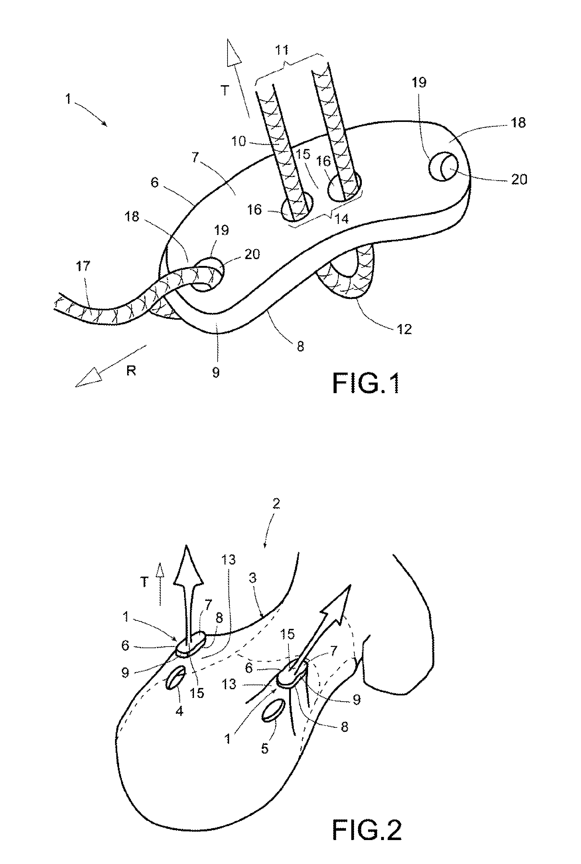 Device for arthroscopic use, and method of diagnosis or treatment of joint ailments using said device