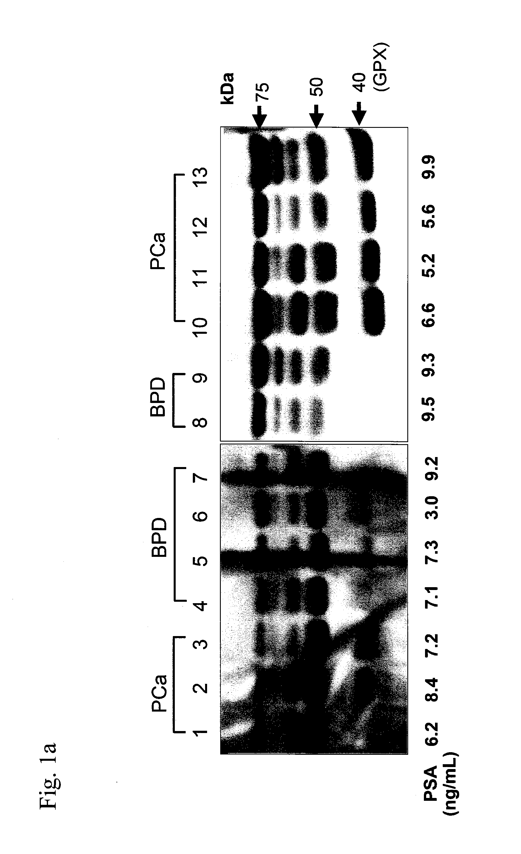 Cancer evaluation method using haptoglobin β chain defined by antibody RM2