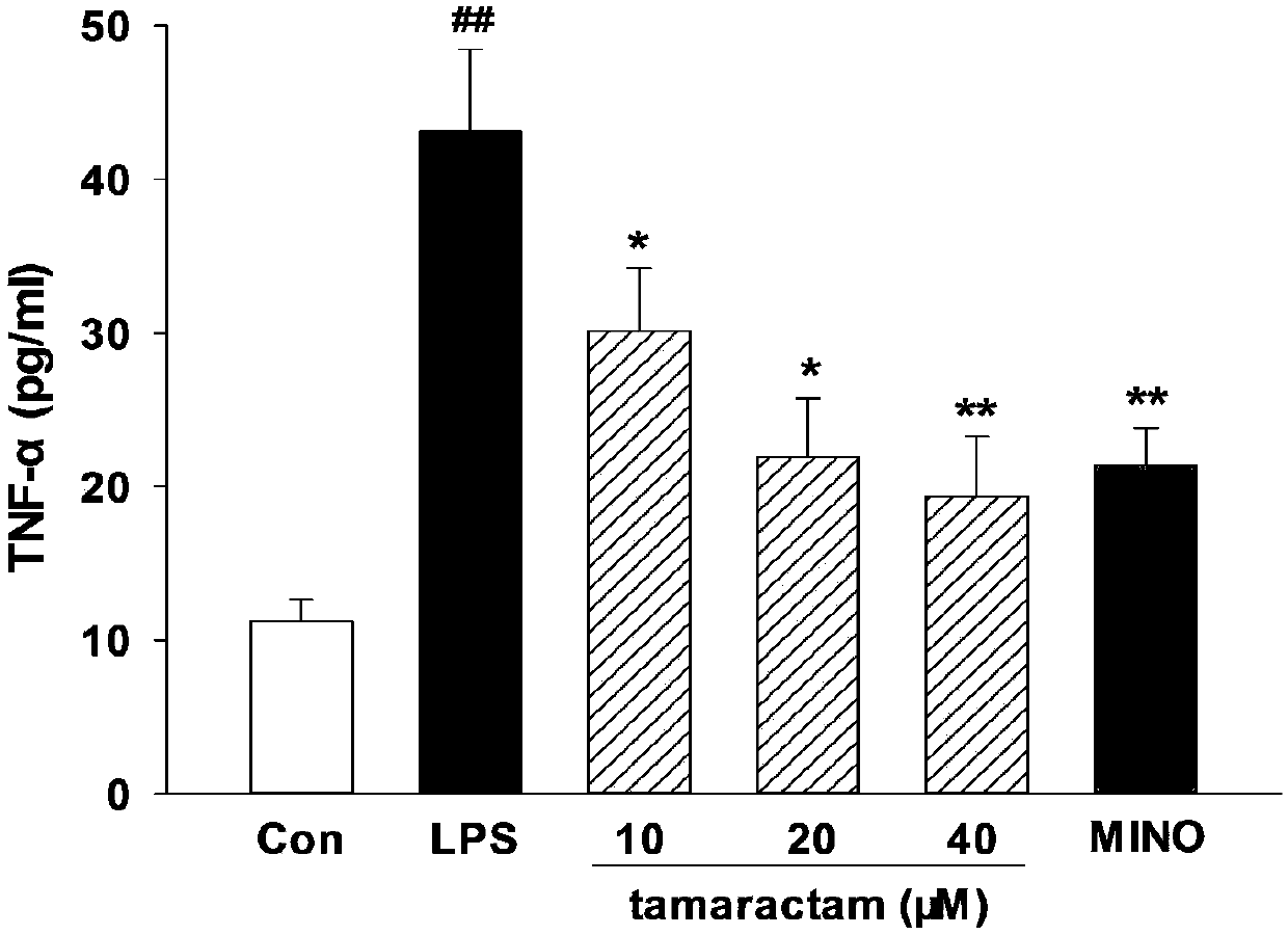 Application of lactan compound to preparation of neuritis inhibiting drugs