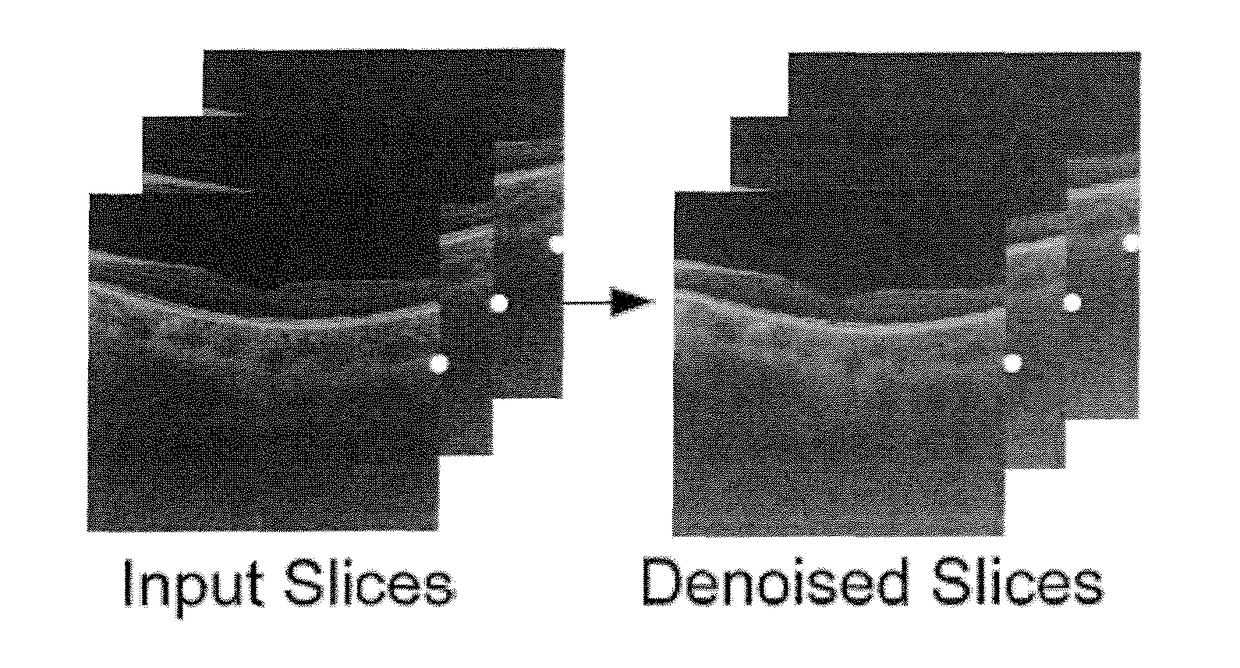 Reducing speckle noise in optical coherence tomography images