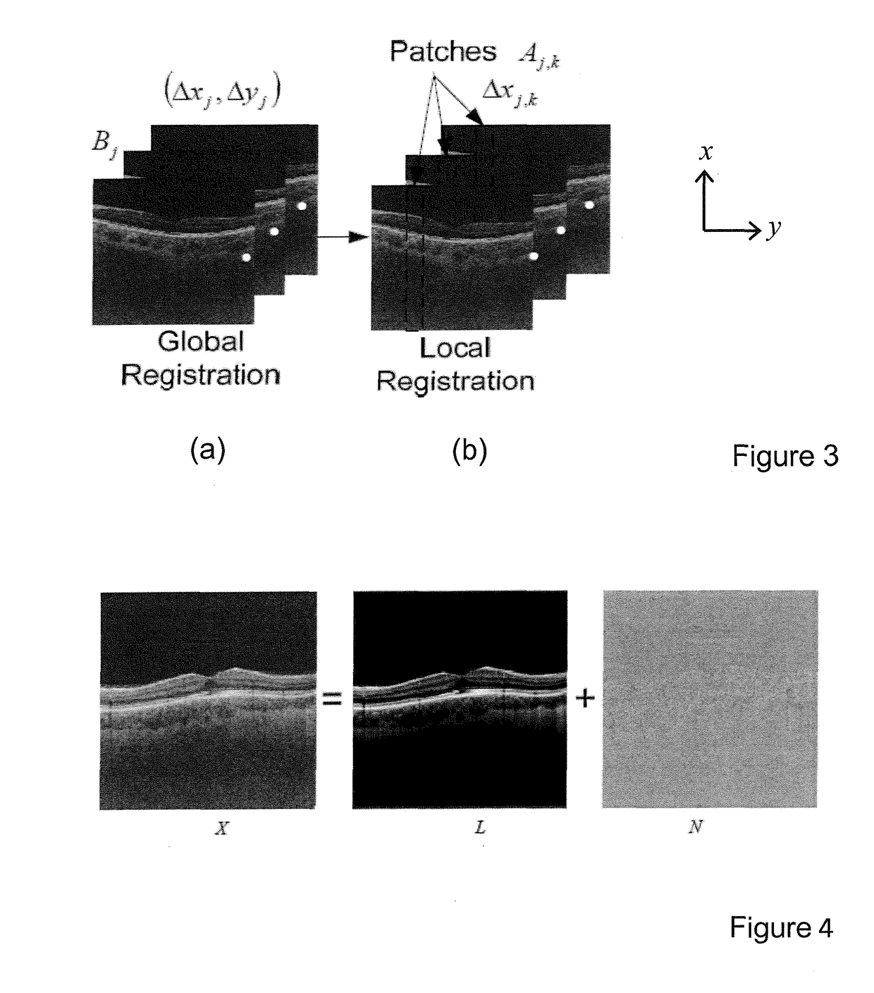 Reducing speckle noise in optical coherence tomography images