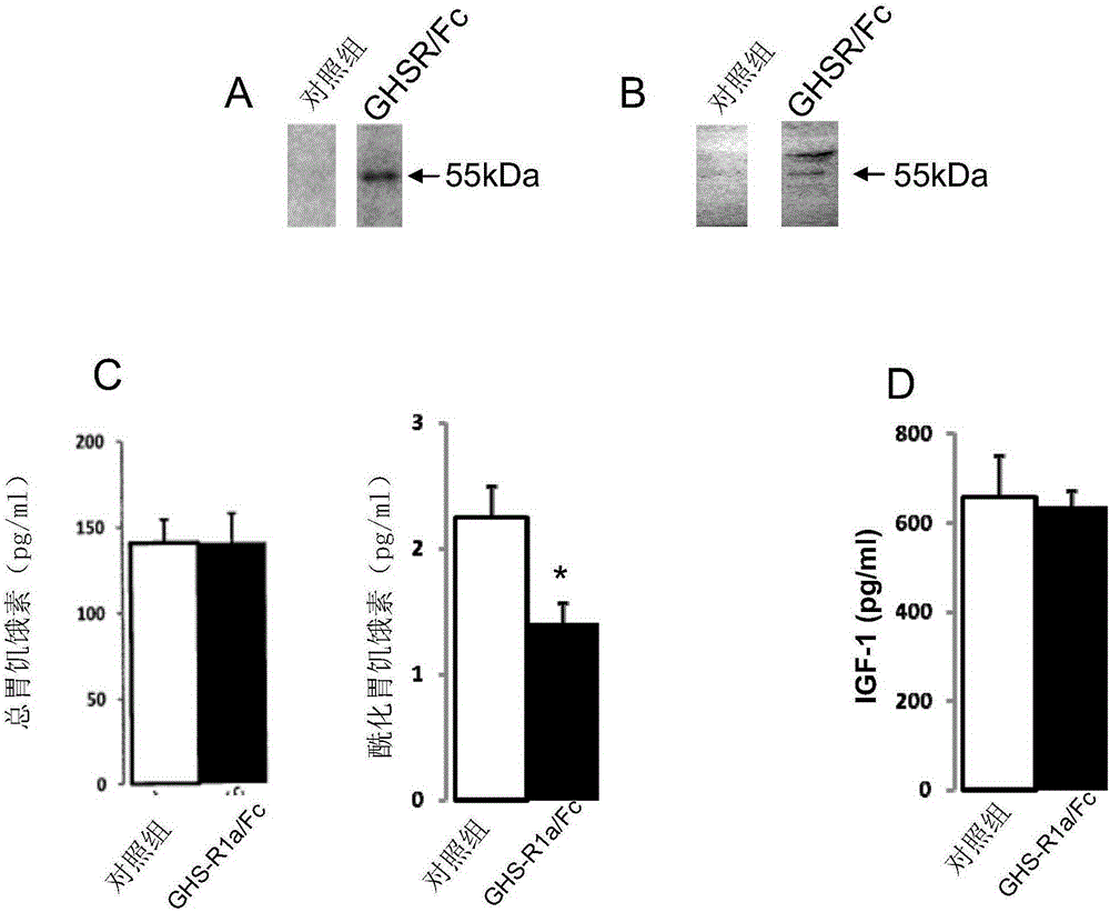 Growth hormone secretagogue receptor based protein, nucleic acids and methods and uses thereof