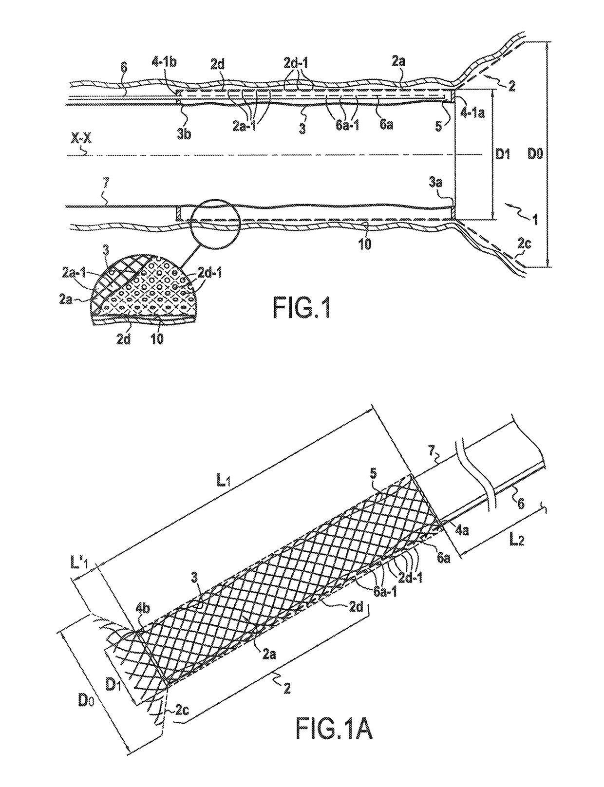 Surgical device for controlled anchoring in the intestine
