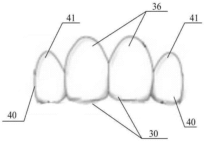 Auxiliary tooth socket applicable to mixed dentition period and manufacturing method