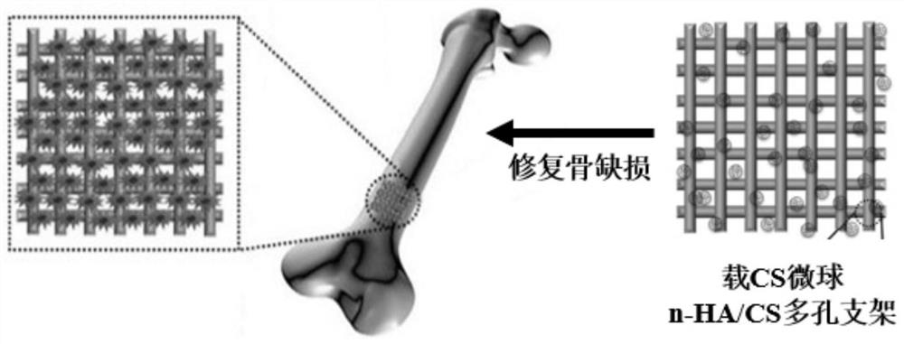 A kind of n-ha/cs porous scaffold for bone repair and its preparation method and application