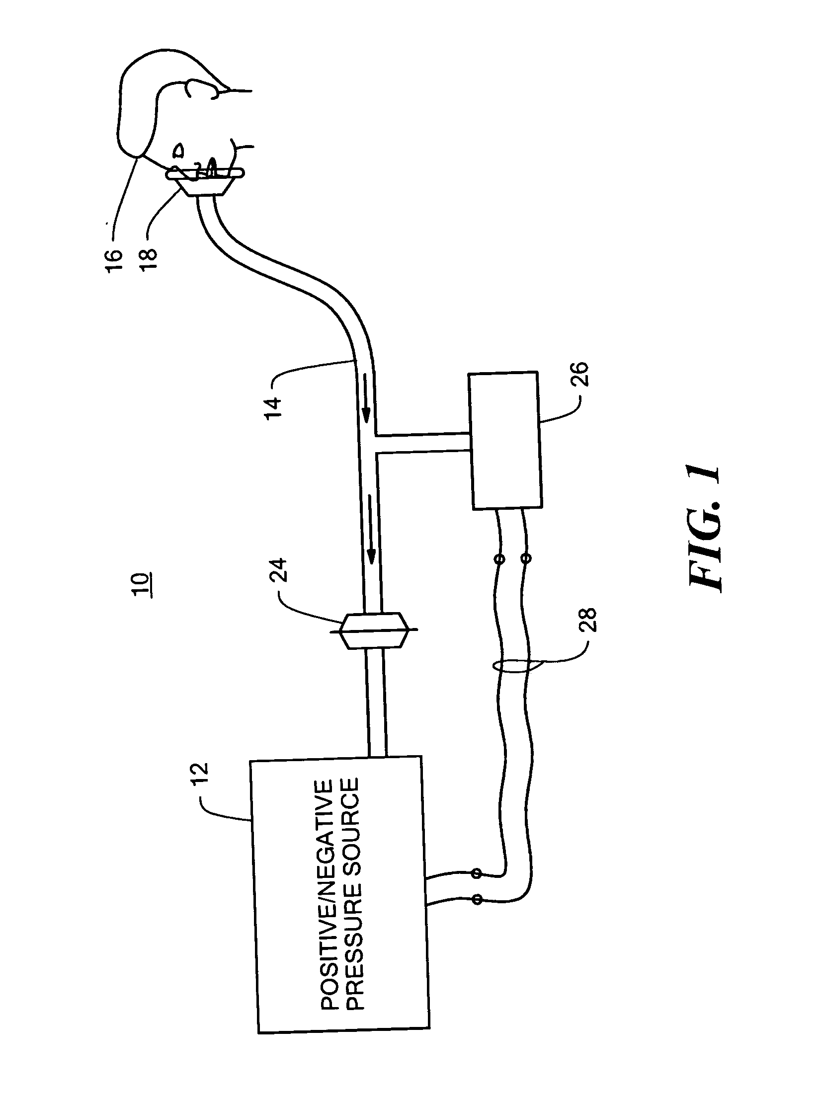 Insufflation-exsufflation system for removal of broncho-pulmonary secretions with automatic triggering of inhalation phase