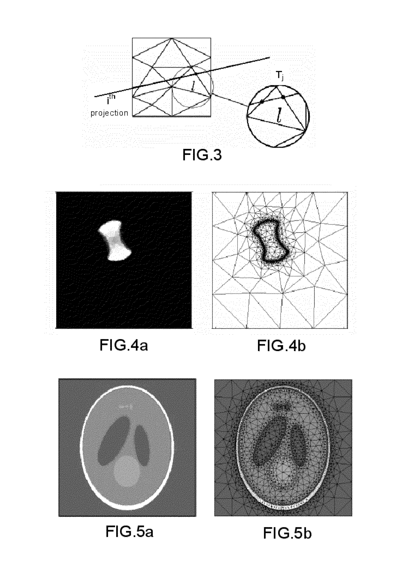 Iterative method for determining a two-dimensional or three-dimensional image on the basis of signals arising from x-ray tomography