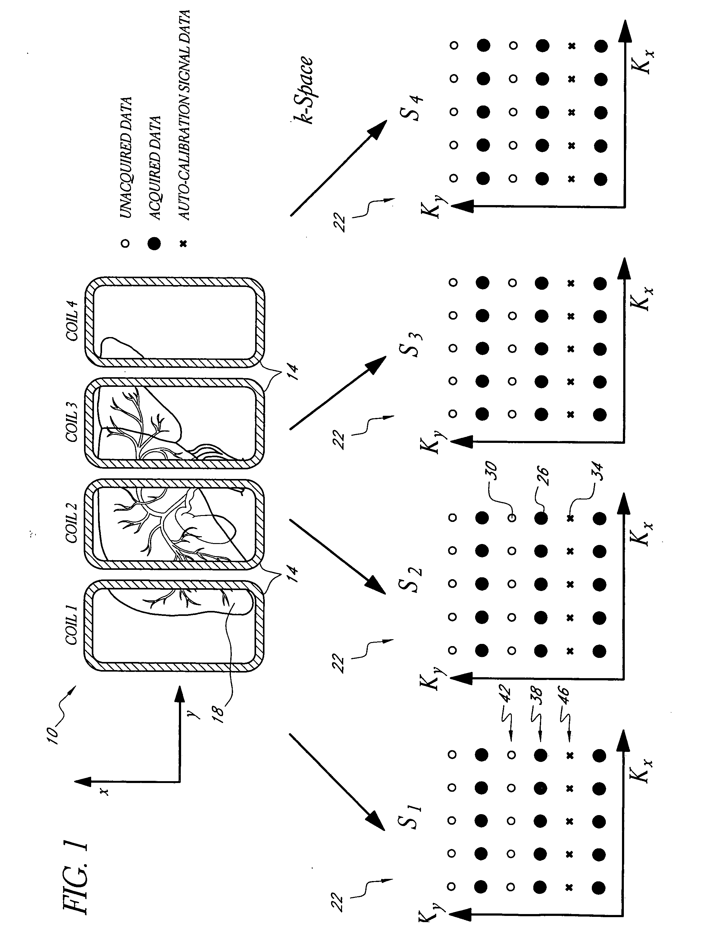 Systems and methods for image reconstruction of sensitivity encoded MRI data