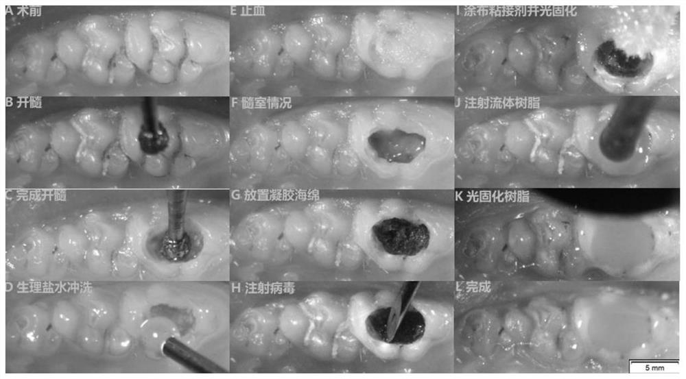 Use of mir-93 inhibitors in the preparation of medicines for repairing dentin