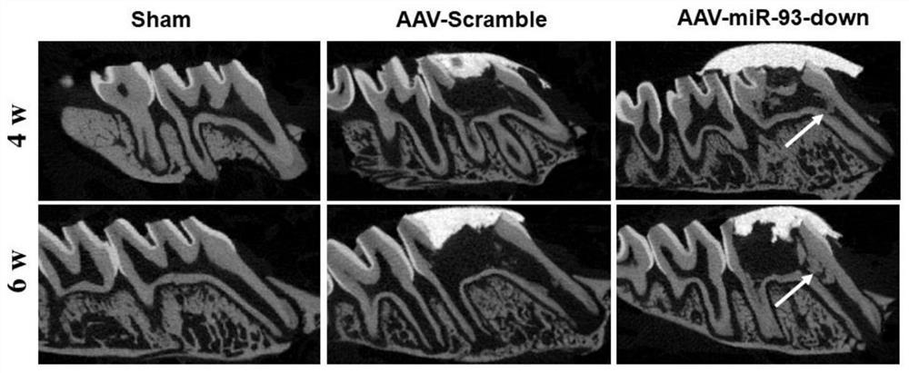 Use of mir-93 inhibitors in the preparation of medicines for repairing dentin