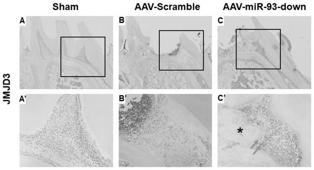 Use of mir-93 inhibitors in the preparation of medicines for repairing dentin