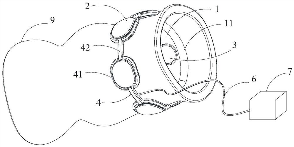 Anastomotic stoma protection device