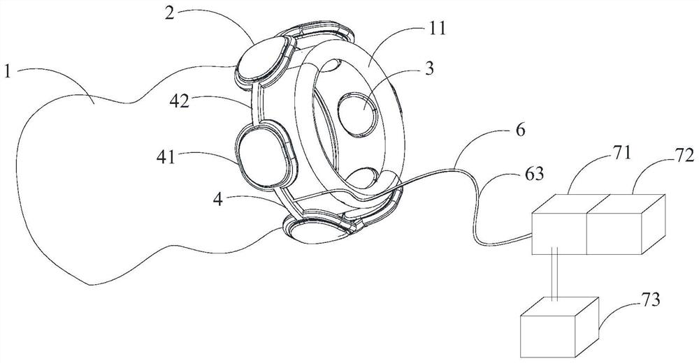 Anastomotic stoma protection device