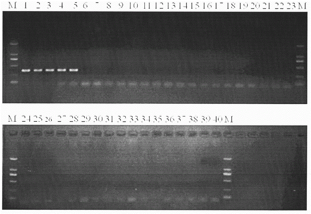 A detection kit and detection method for Fusarium wilt of cabbage