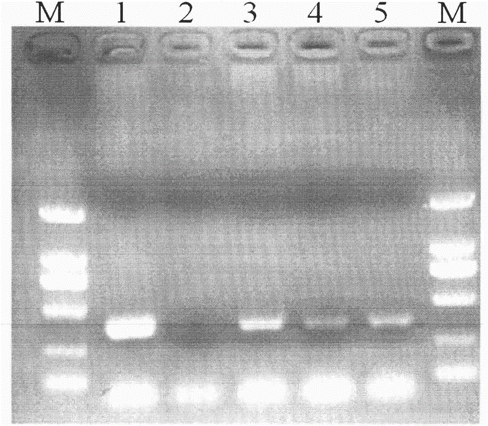 A detection kit and detection method for Fusarium wilt of cabbage