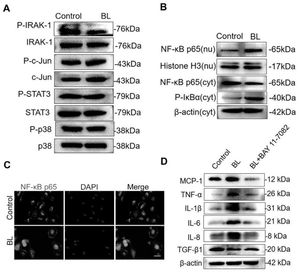 Application of thrombospondin 1 (THBS-1) in preparation of medicine for preventing and/or treating age-related macular degeneration (AMD)