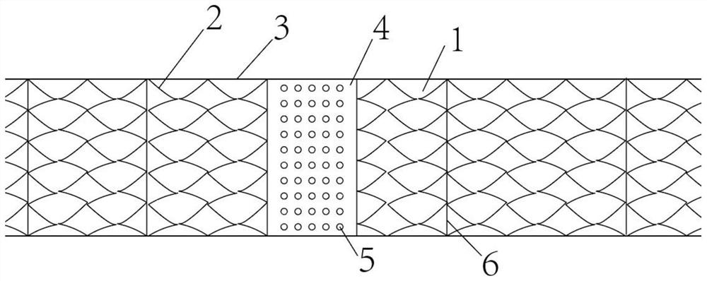 Artery peripheral sucker stent and mounting method thereof
