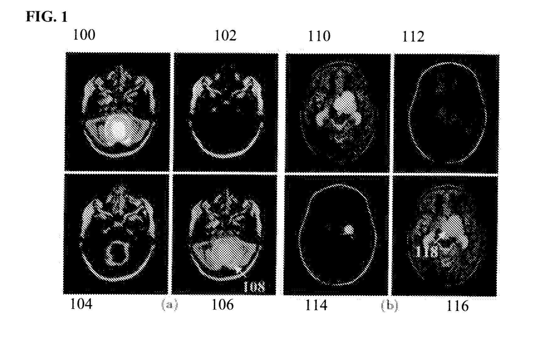 Method and System for Brain Tumor Segmentation in 3D Magnetic Resonance Images