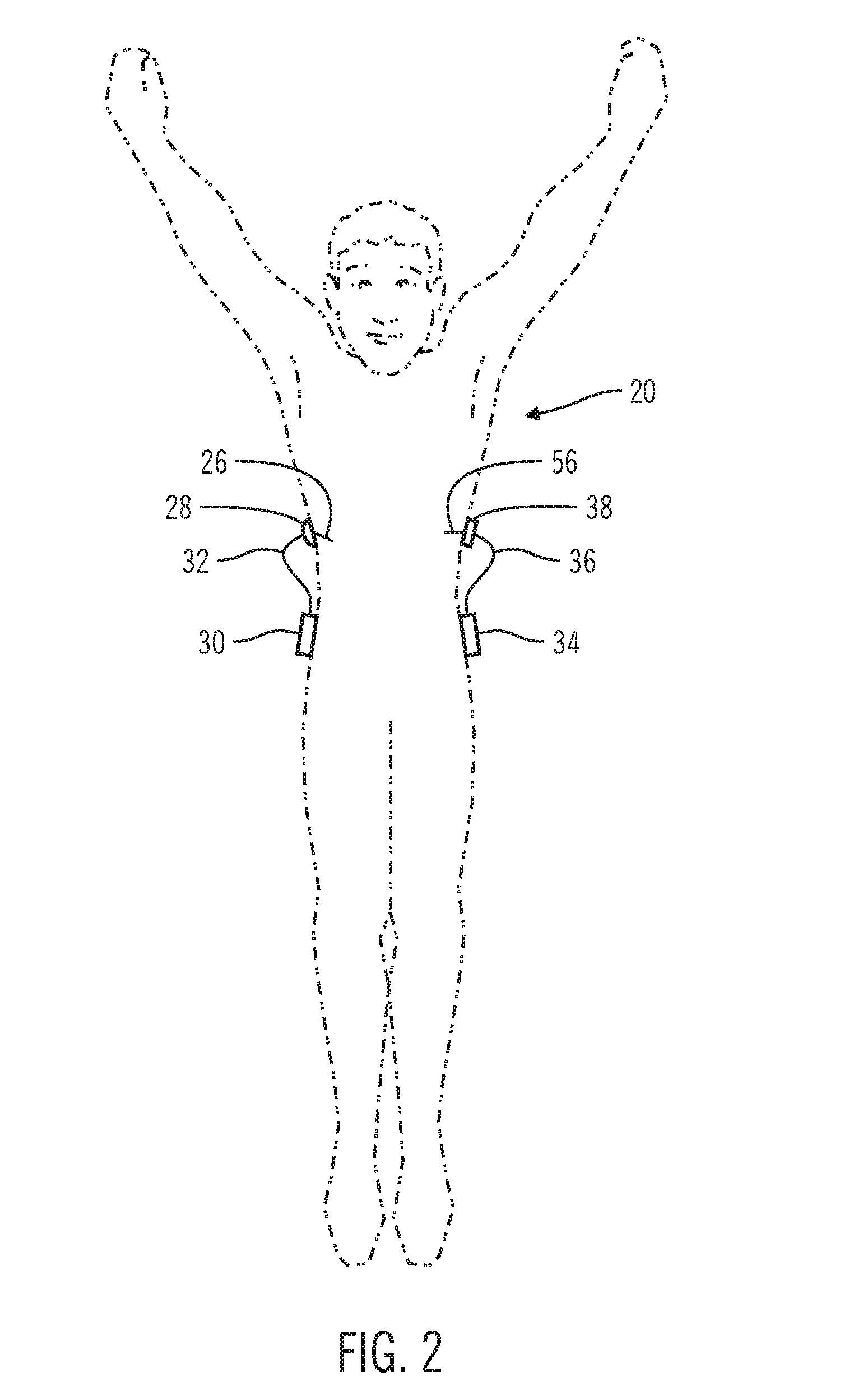 Sensor model supervisor for a closed-loop insulin infusion system