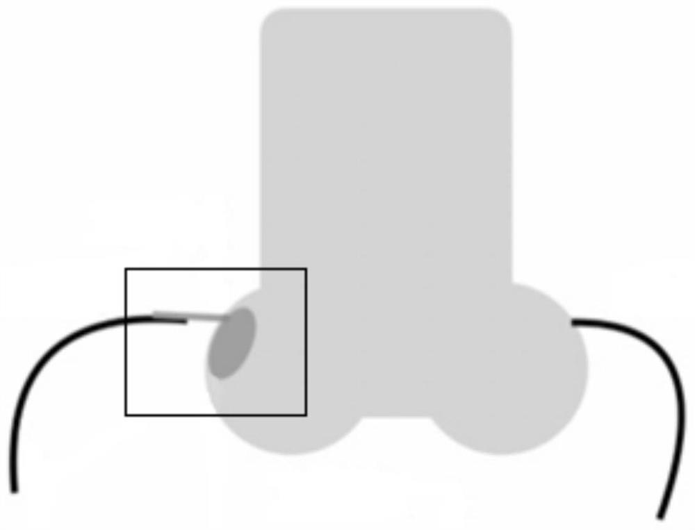 A blood vessel segmentation method, device and computer storage medium