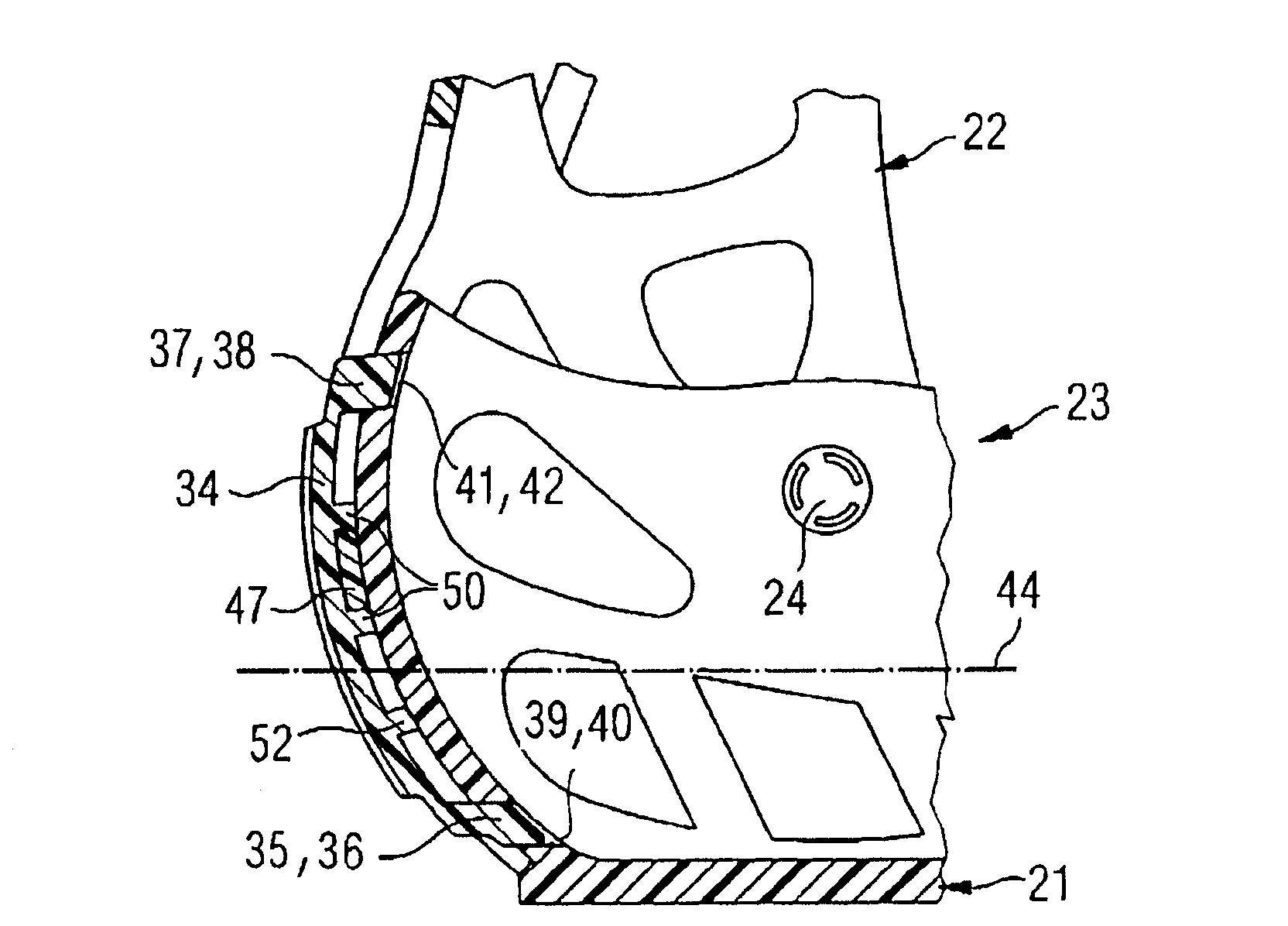 Casing structure for fixing and containing shank