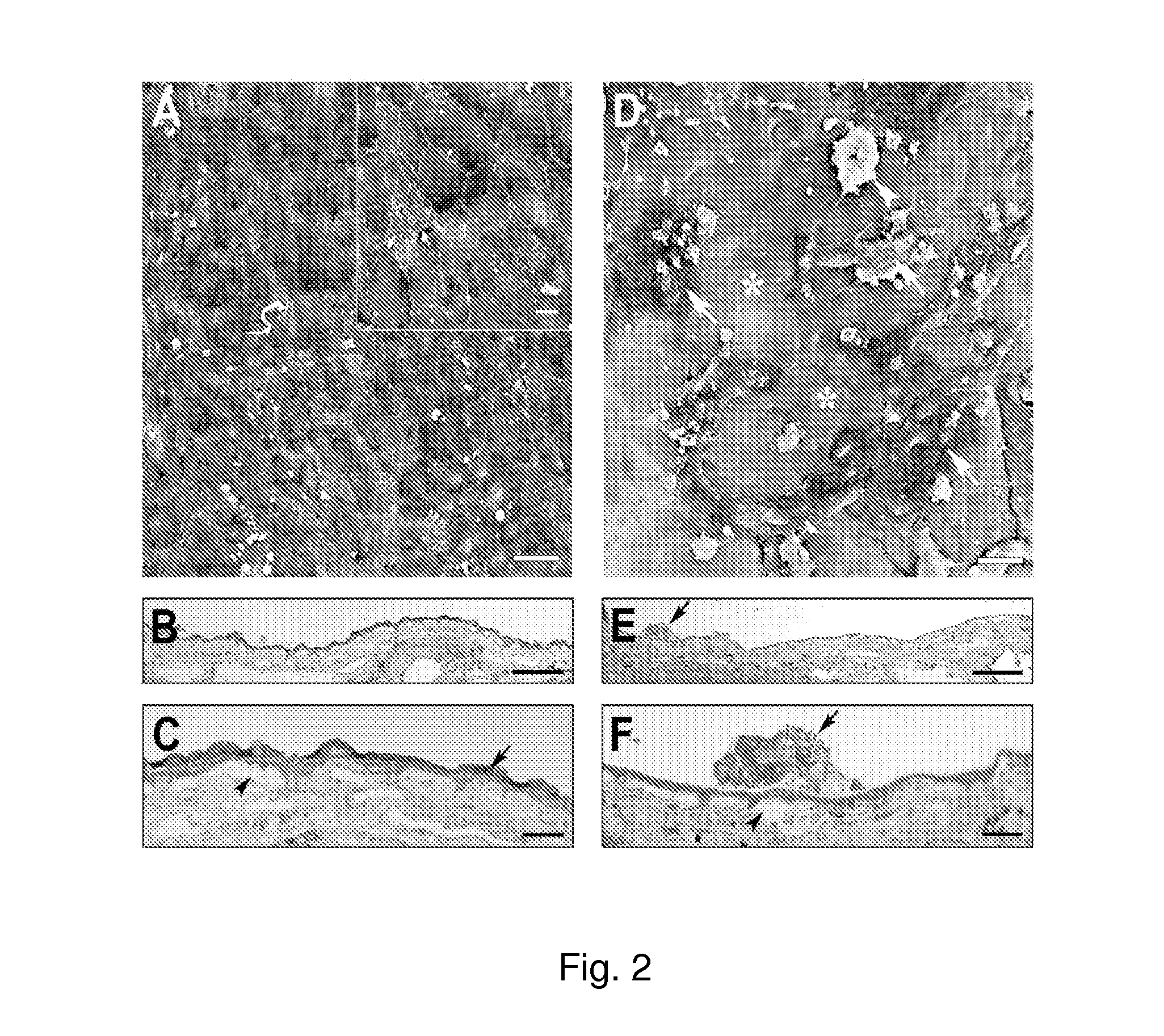 Method of using an extracellular matrix to enhance cell transplant survival and differentiation