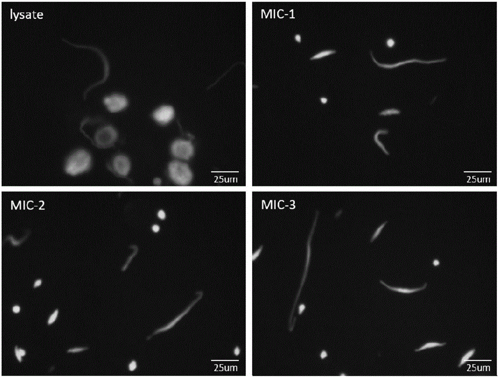 Separation and purification method of crosslinked tetrahymena micronucleus