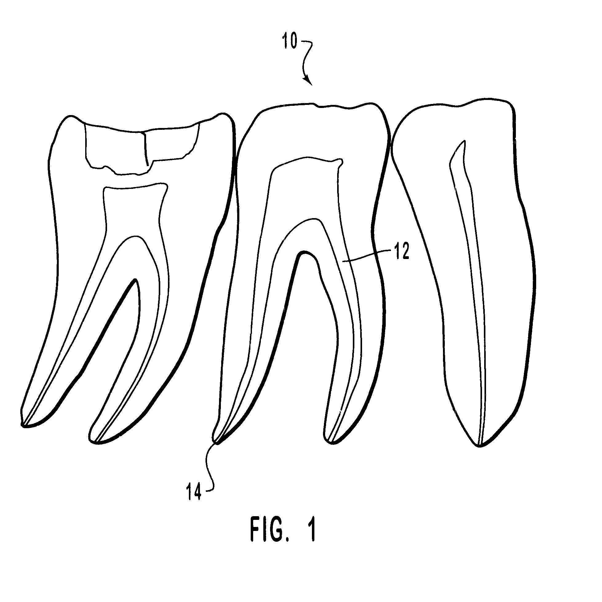 Abrasive radiopaque endodontic marking tools and related methods