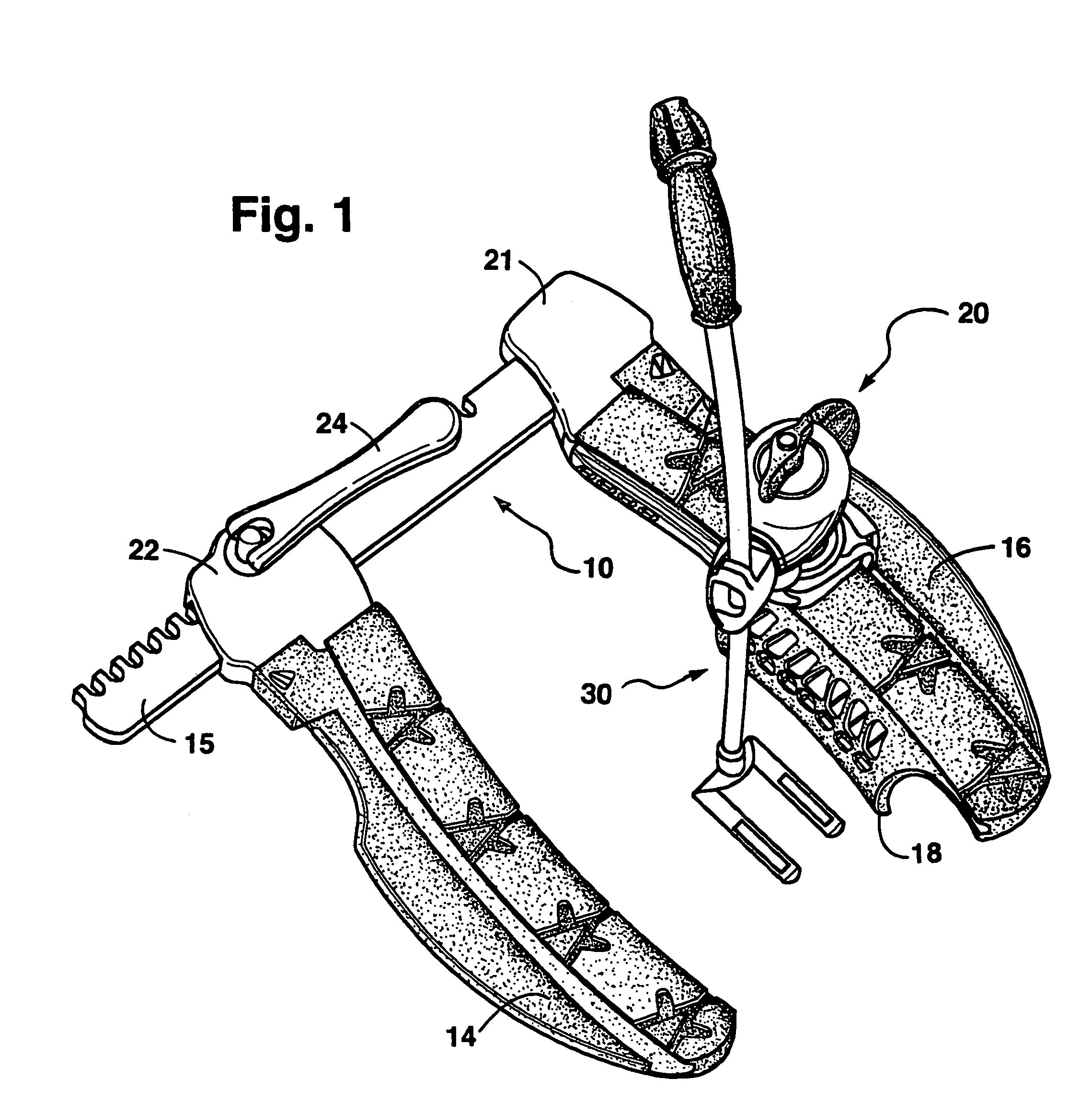 Surgical retractor blade and system