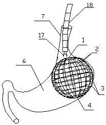 Spherical scaffold used in stomach
