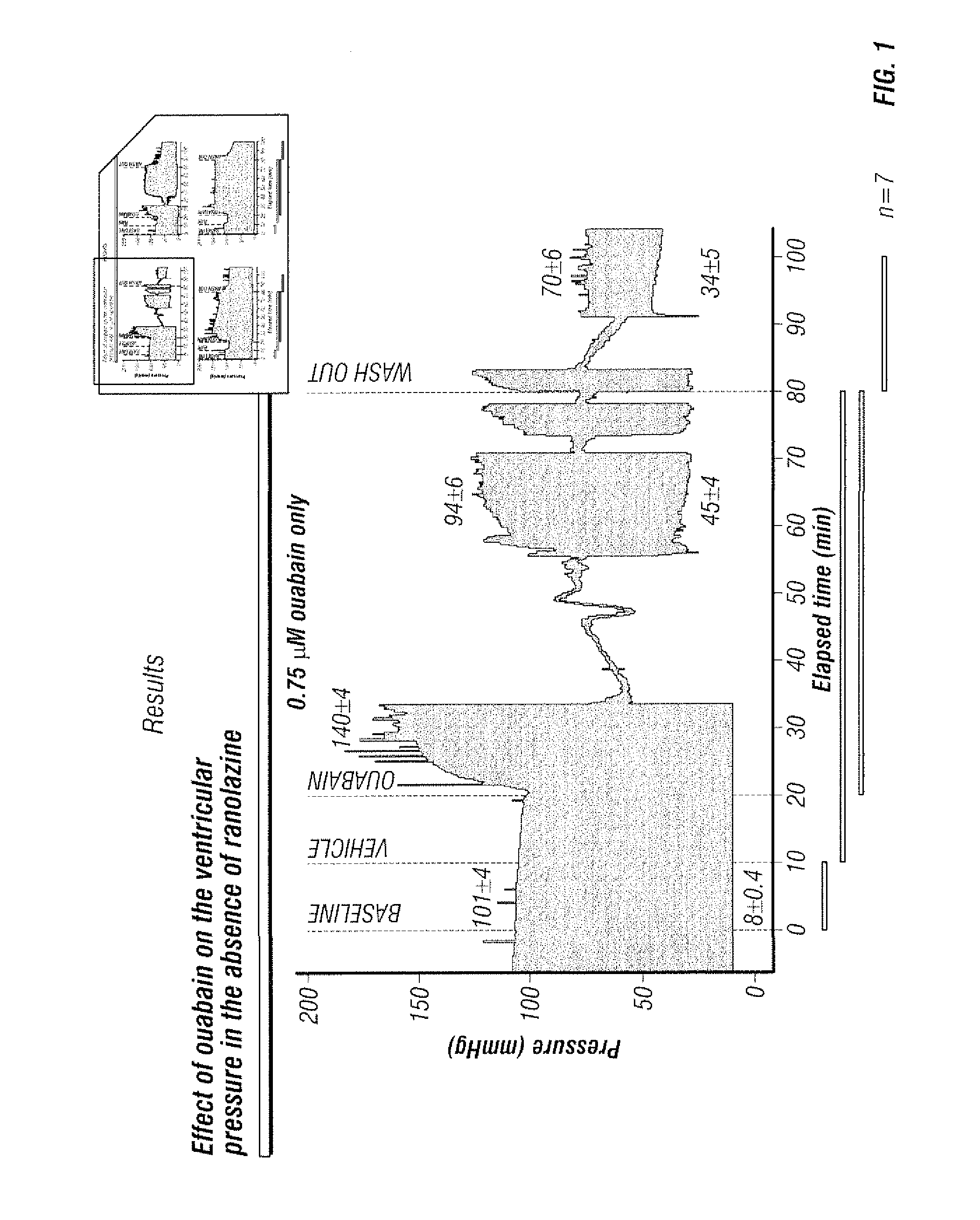 Co-administration of ranolazine and cardiac glycosides