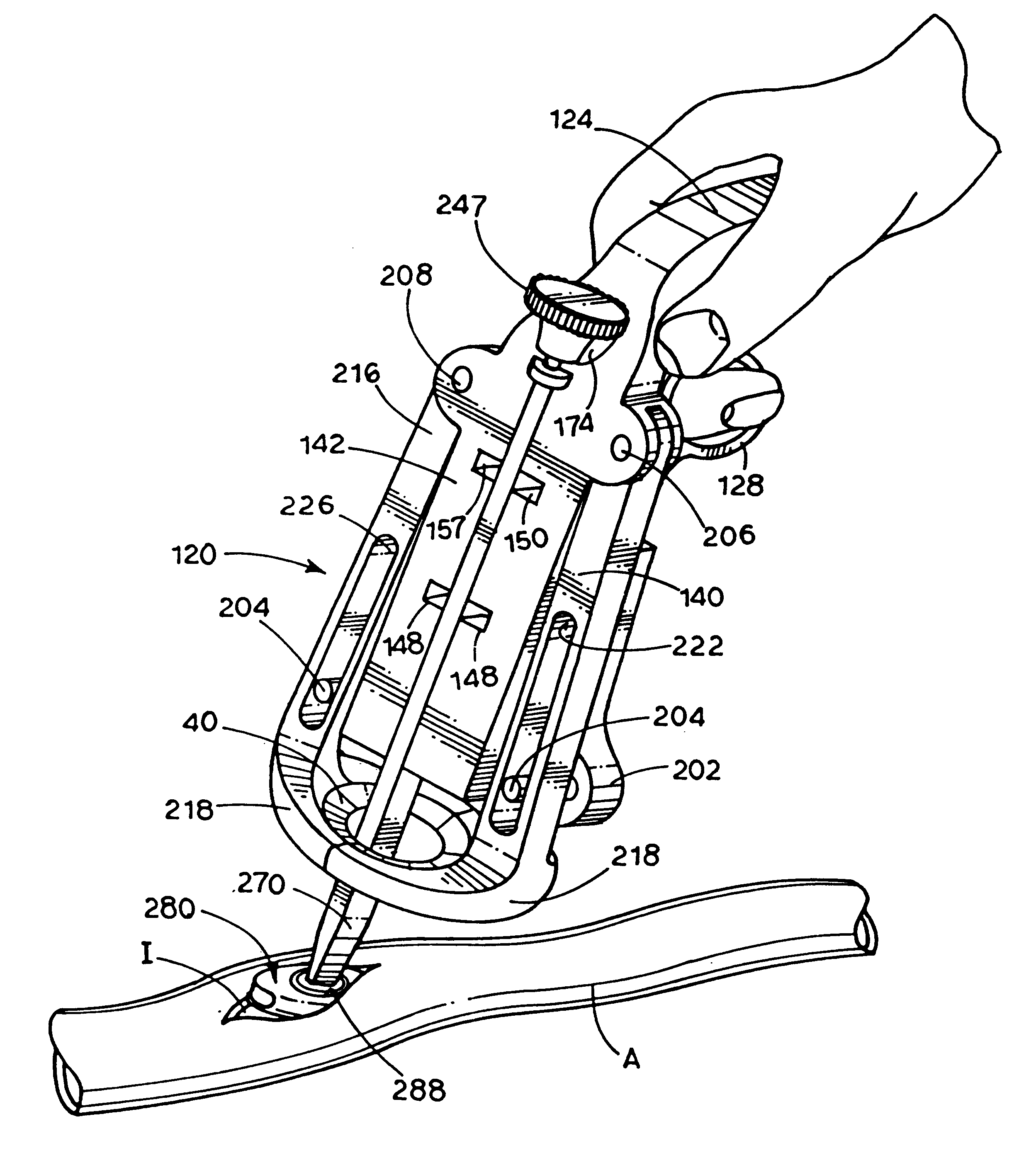 Means and method for performing an anastomosis