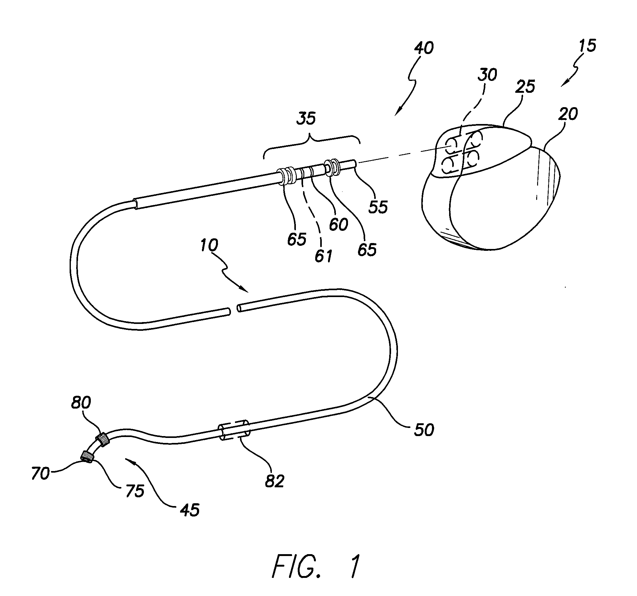 MRI compatible implantable medical lead and method of making same