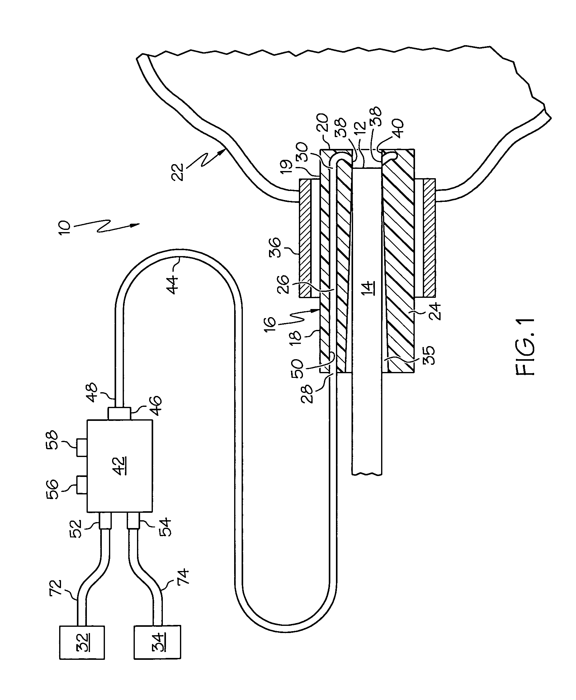 Apparatus for cleaning a distal scope end of a medical viewing scope
