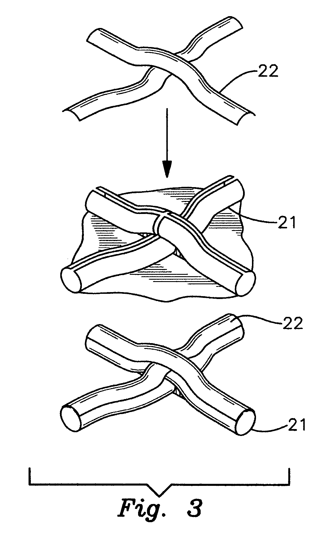 Stringing sandwich, an apparatus that lays strings on top of each other within a frame of a racquet