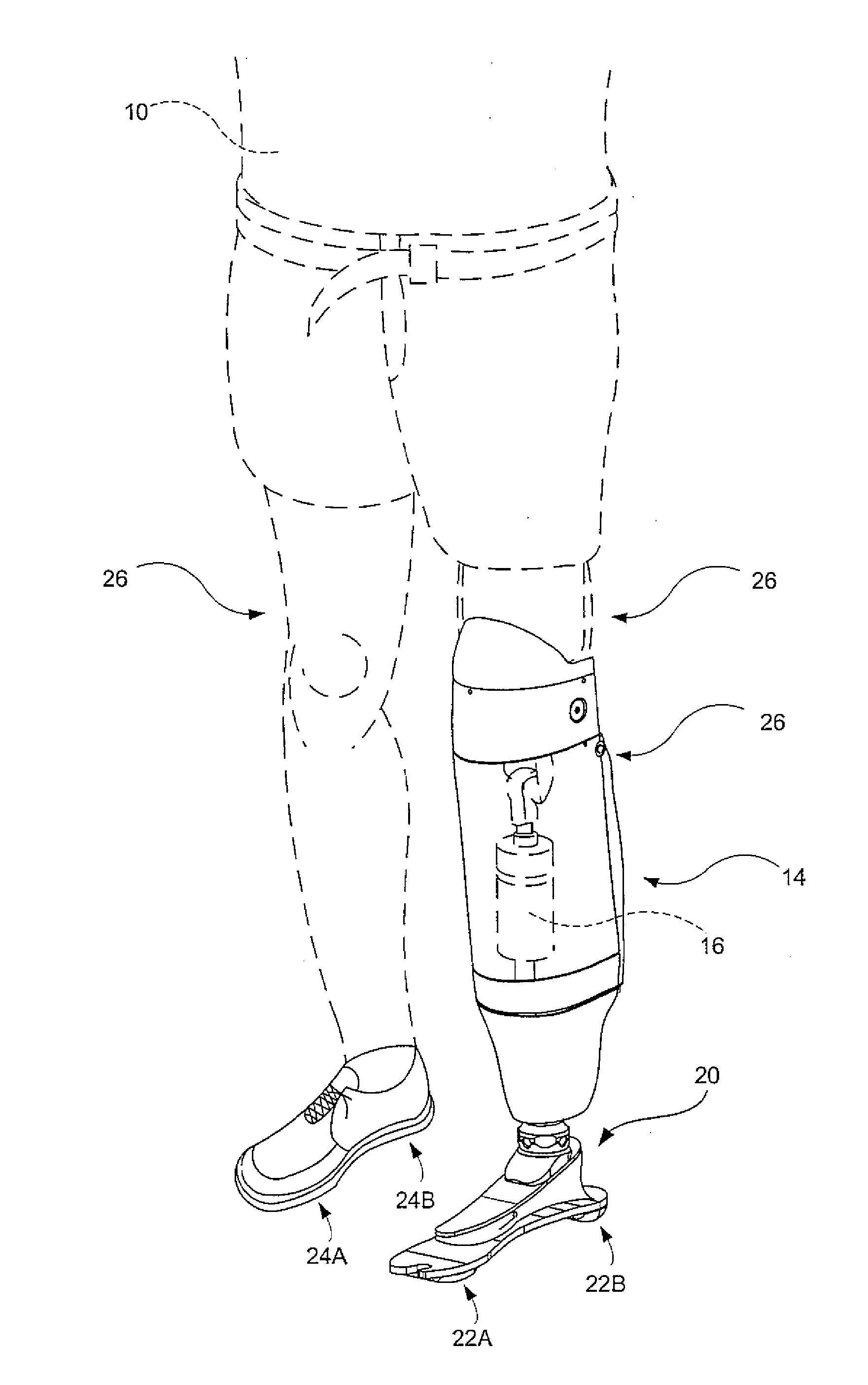 Instrumented prosthetic foot