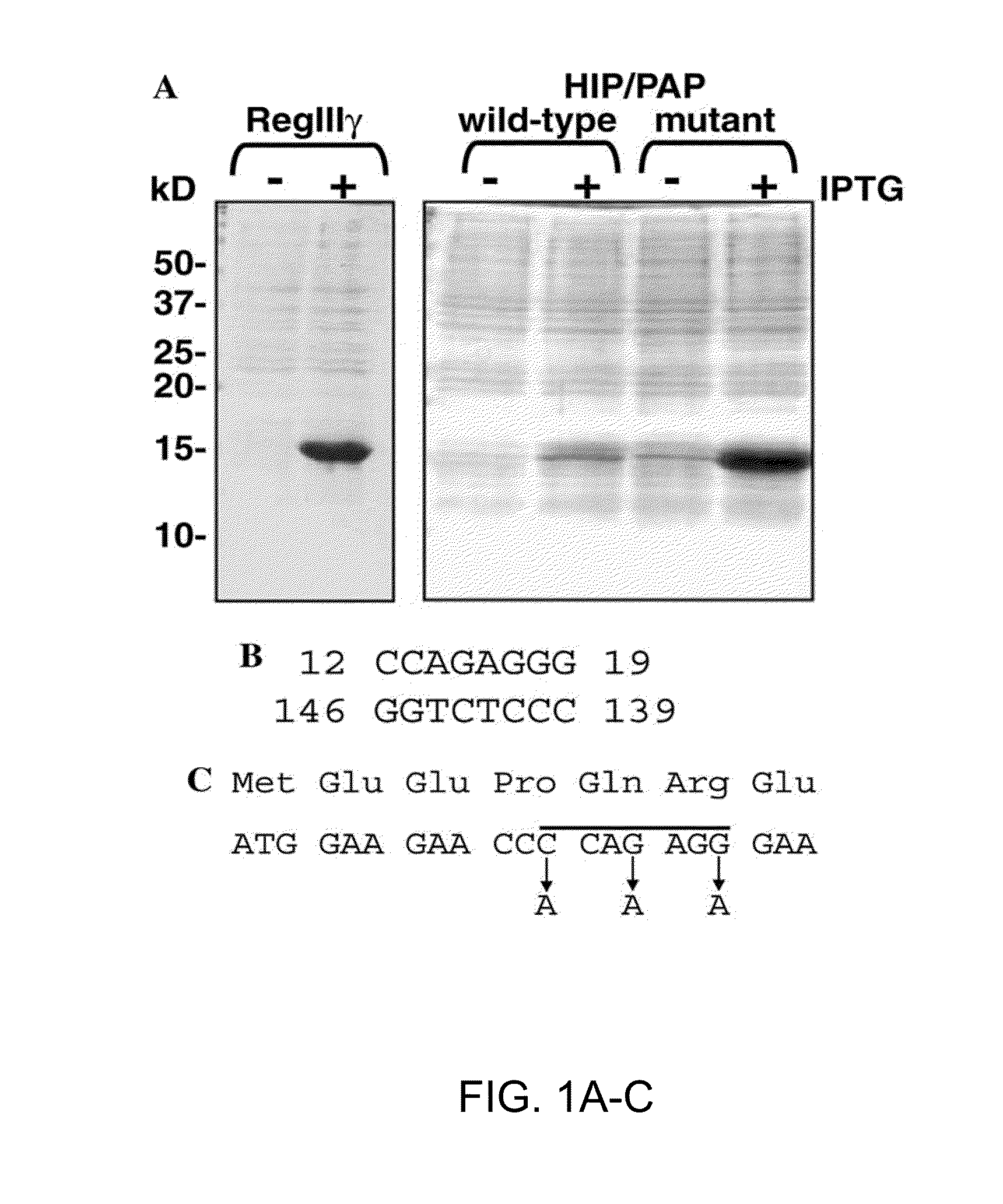 Expression and Purification of HIP/PAP and Uses Therefor