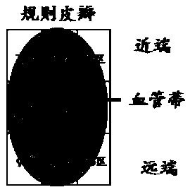 Skin flap transplantation postoperative nursing monitoring method and system, and skin flap transplantation postoperative nursing data management method and equipment