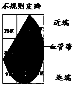 Skin flap transplantation postoperative nursing monitoring method and system, and skin flap transplantation postoperative nursing data management method and equipment