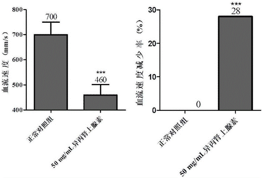 Method for evaluating toxicity of myocardial injury inducing agent and efficacy of myocardial injury treating agent by using zebra fish